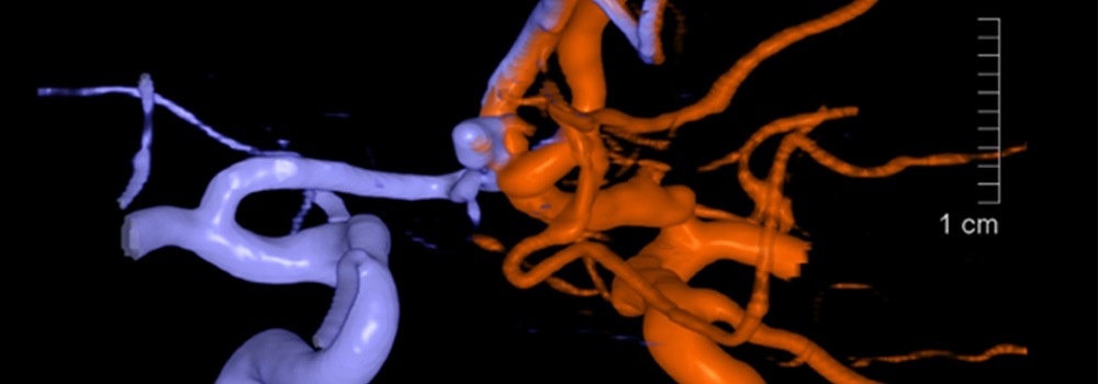 Angiography Imaging